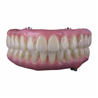 Titanium Hybrid Malo Bridge implantat za puna usta